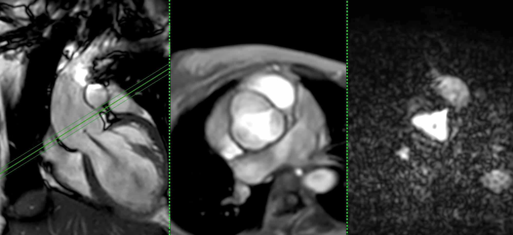 Case 131: When the Dilatation is Mechanical