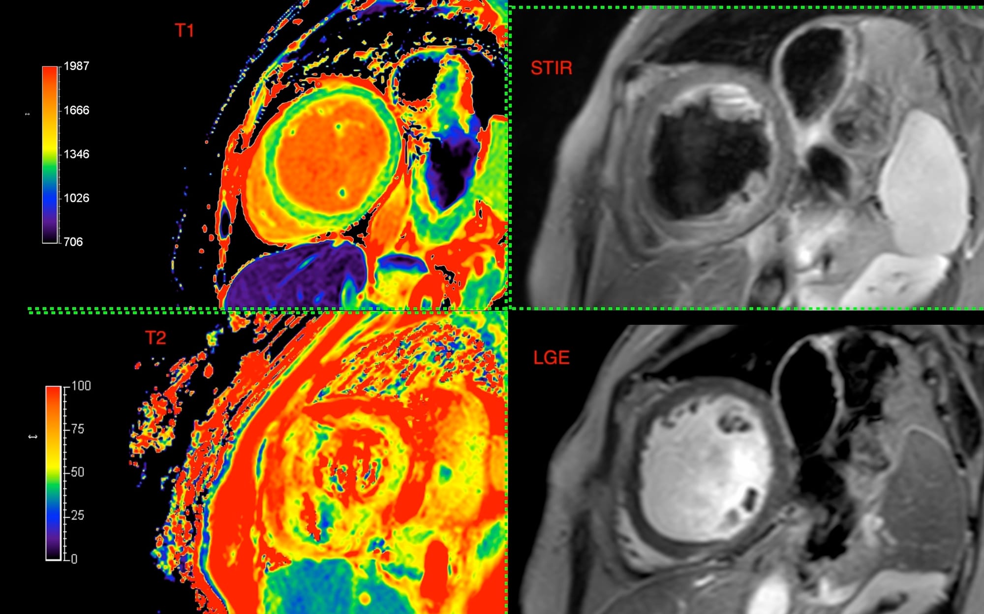 Case 131: When the Dilatation is Mechanical