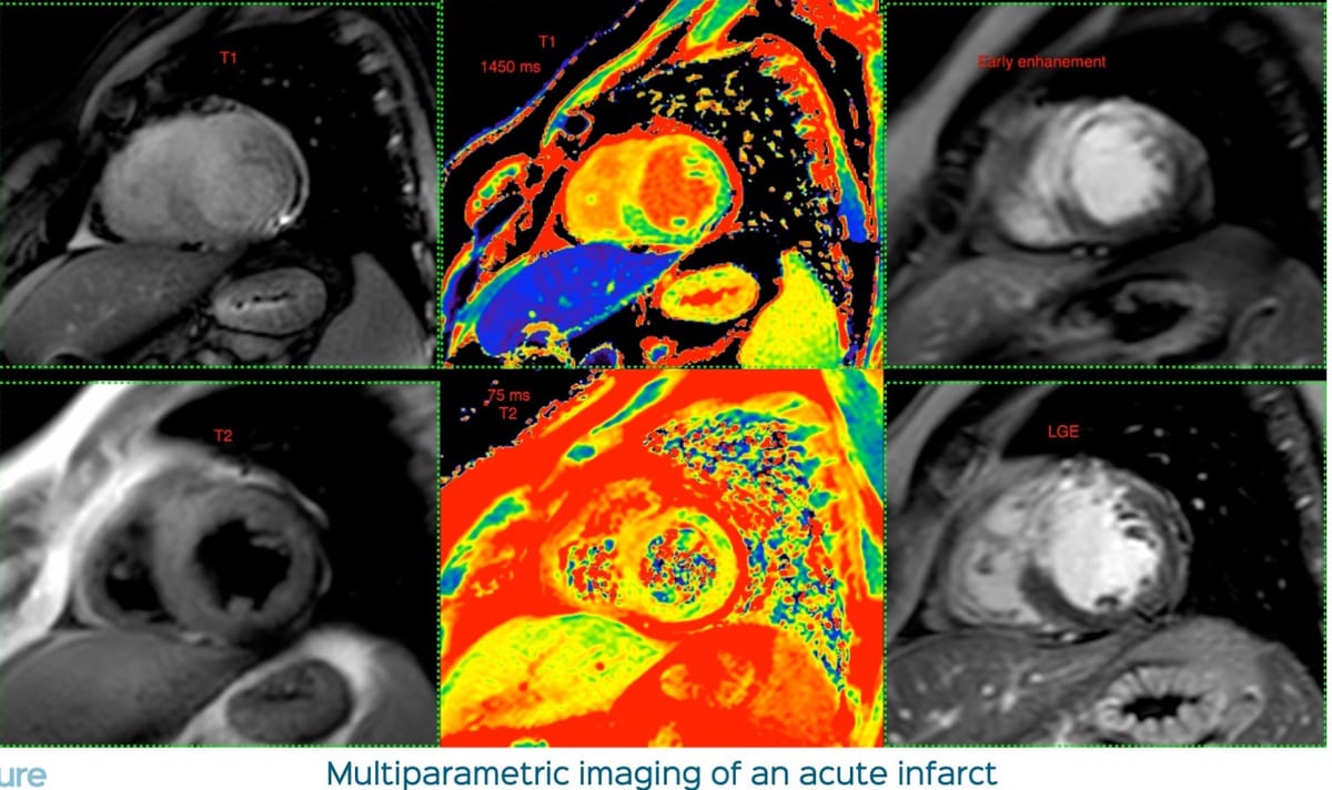 Lecture: CMR in Viability - Updates