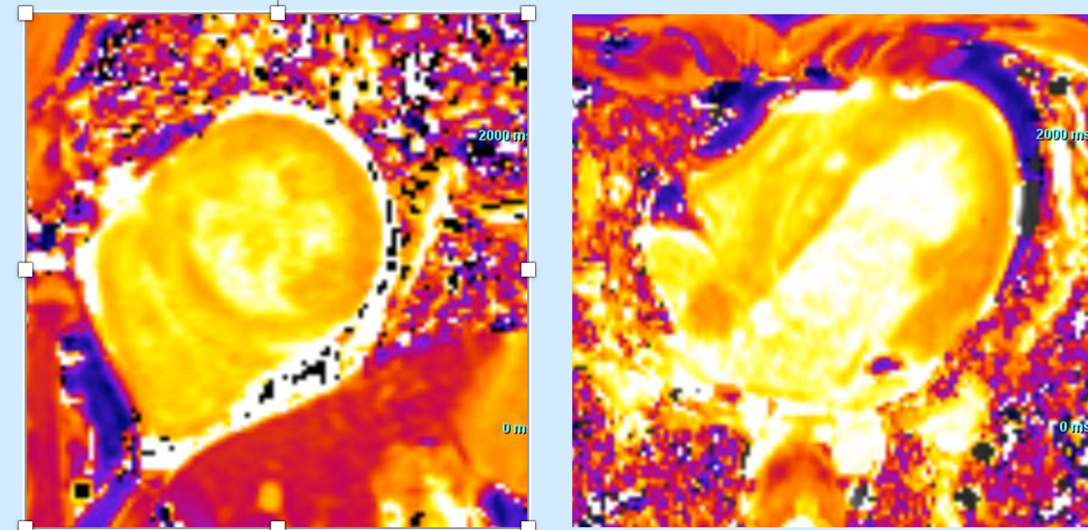 Parametric mapping