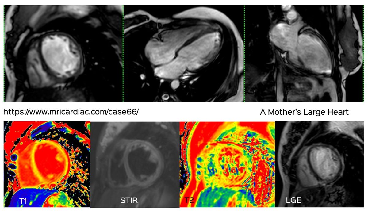 Case 66: A Mother's Large Heart