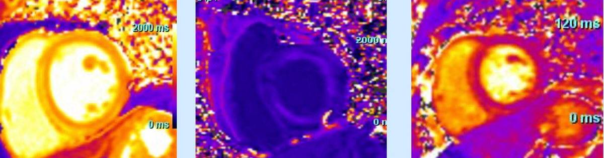 SCD: Review of cases