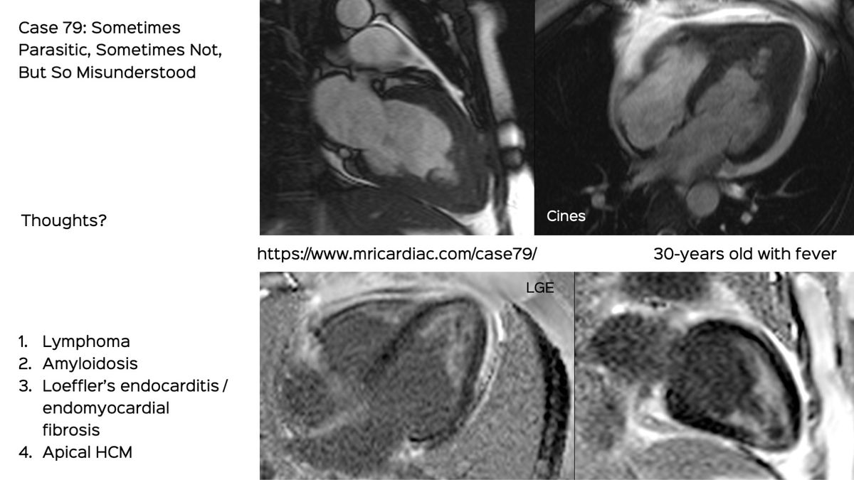 Case 79: Sometimes Parasitic, Sometimes Not, But So Misunderstood