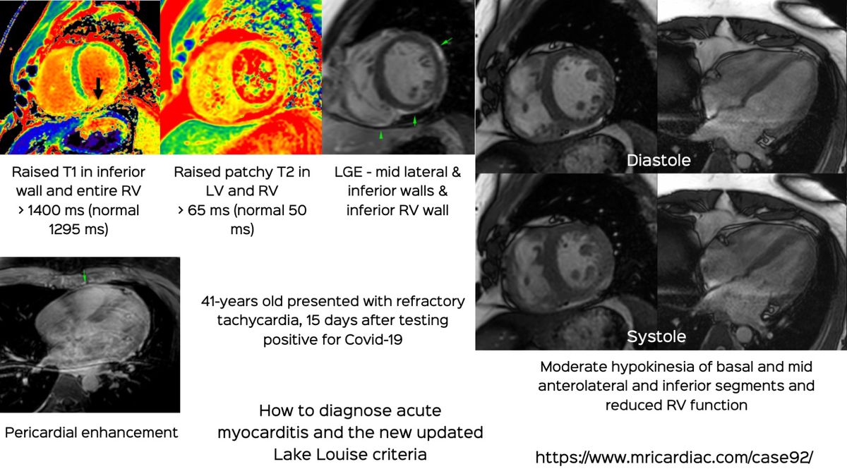 Case 92: When 2/2 Gives Us The Confidence to Make the Diagnosis