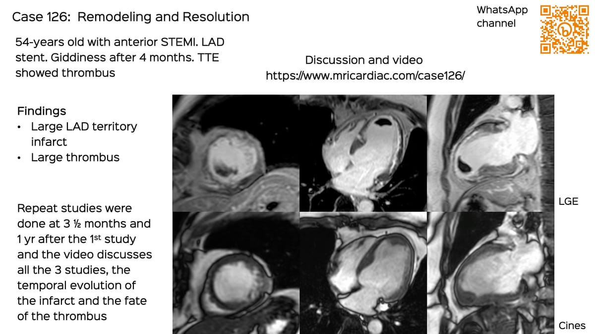 Case 126: Remodeling and Resolution