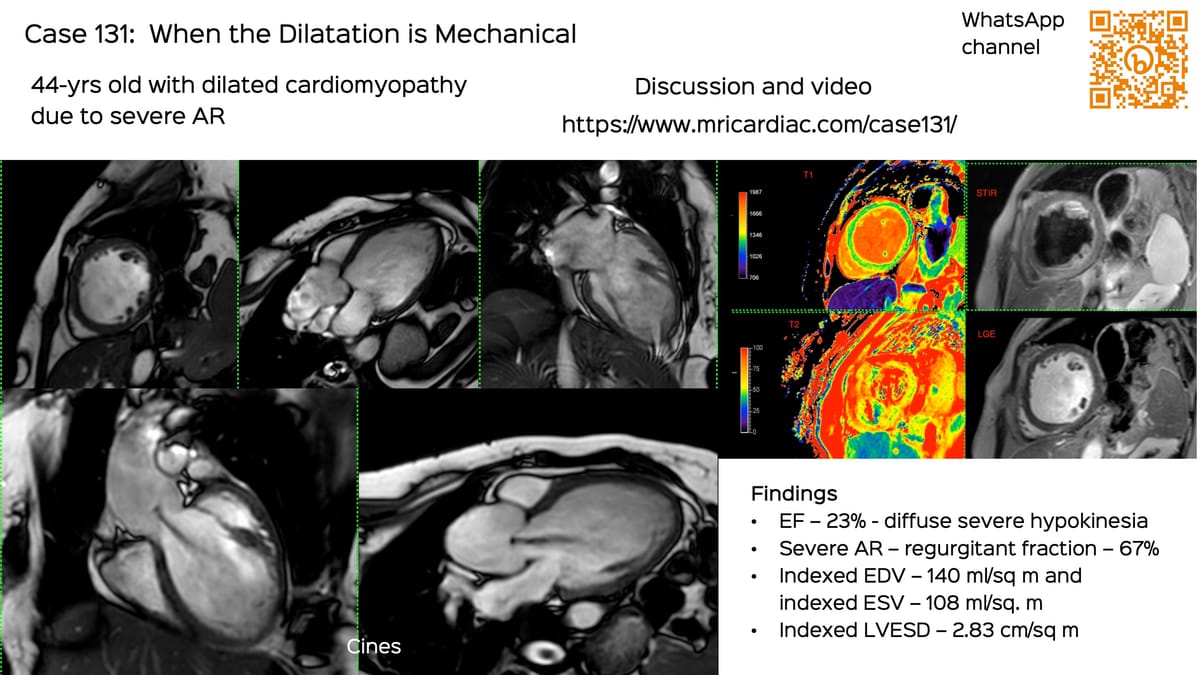 Case 131: When the Dilatation is Mechanical
