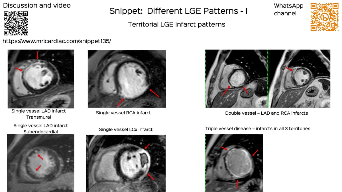 Lecture: NSIP and OP