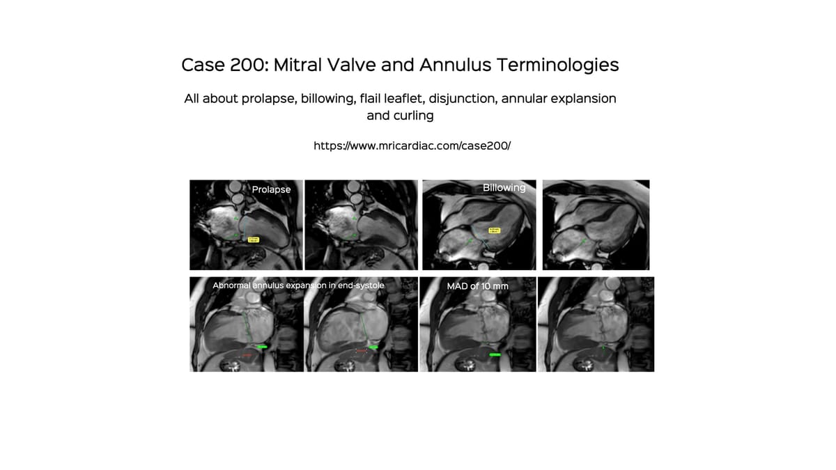 Case 200: Mitral Valve and Annular Terminologies