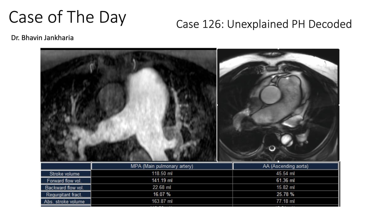 Case of the Day 126 - Unexplained Pulmonary Hypertension Decoded