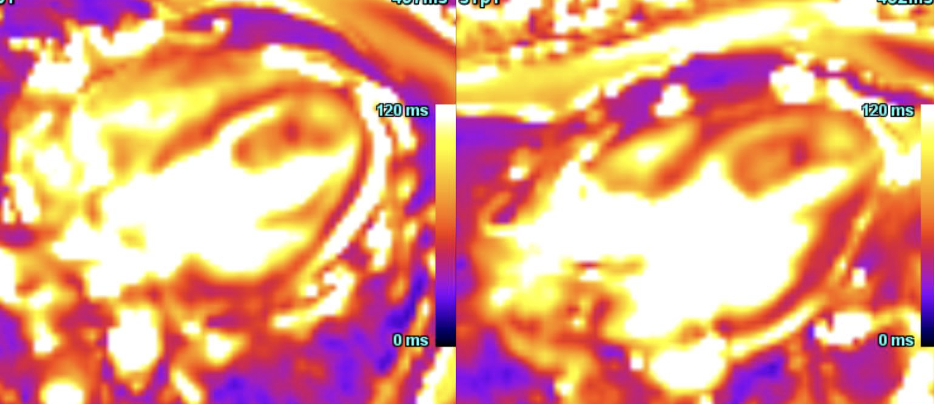 Uncommon presentation: Common pathology