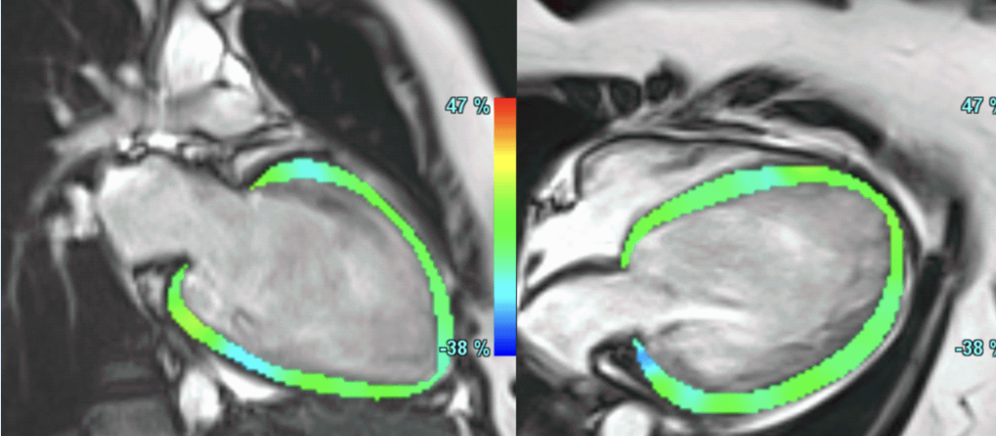 Not in Sync anymore..!