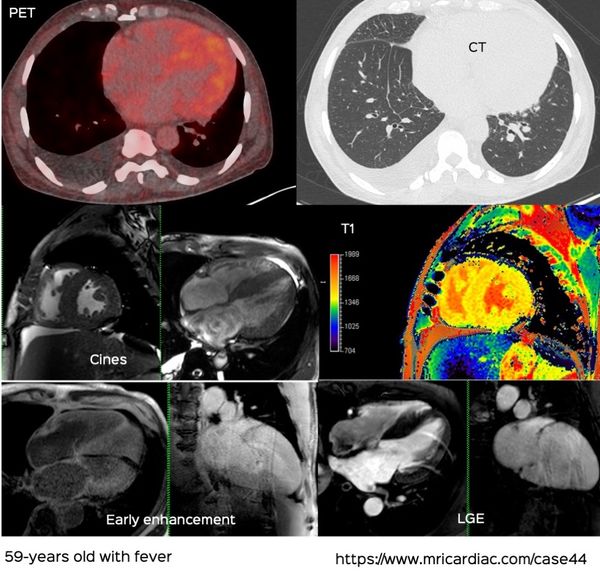 Looking at the Heart On Every Cross-Sectional Thoracic Study