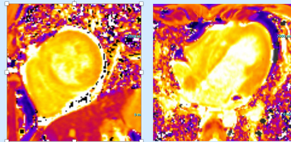 Parametric mapping