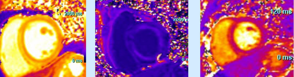 SCD: Review of cases