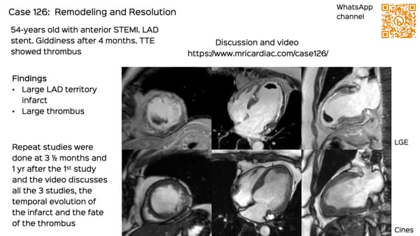 Case 126: Remodeling and Resolution