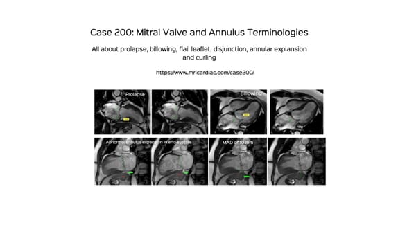 Case 200: Mitral Valve and Annular Terminologies