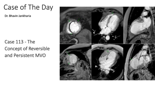 Case of the Day 113 - The Concept of Reversible and Persistent MVO
