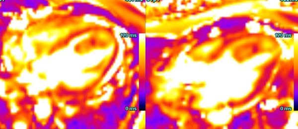 Uncommon presentation: Common pathology