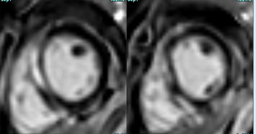 Routine case: Real danger