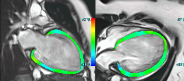 Not in Sync anymore..!